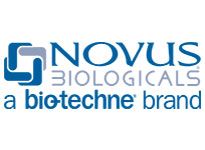 http://www.odakglobal.com.tr/wp-content/uploads/2020/06/novus.jpg
